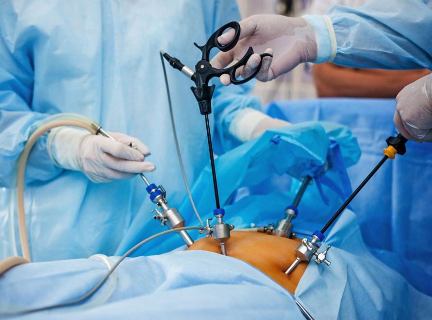 Λαπαροσκοπική Χειρουργική | Χειρουργός Ουρολόγος Δρ. Μάρκος Καραβιτάκης